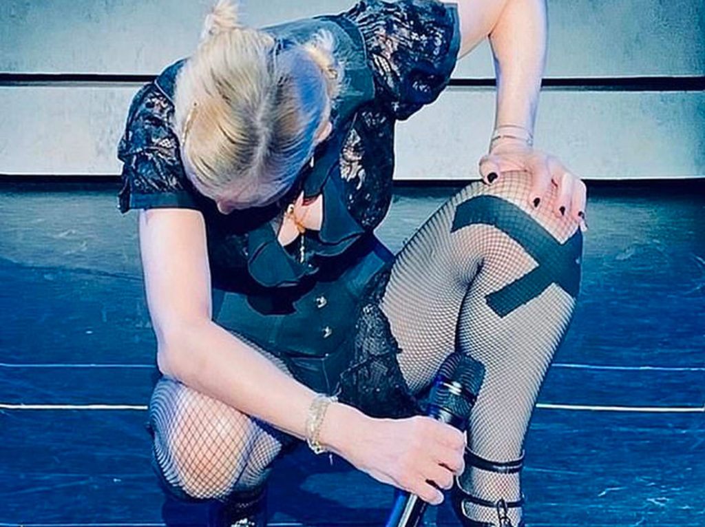Madonna lesión de rodilla